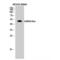 Gamma-Aminobutyric Acid Type A Receptor Alpha6 Subunit antibody, LS-C383609, Lifespan Biosciences, Western Blot image 