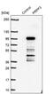 Pre-MRNA Processing Factor 3 antibody, PA5-55550, Invitrogen Antibodies, Western Blot image 