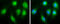 Thrombospondin 1 antibody, GTX130967, GeneTex, Immunofluorescence image 