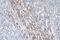 CD46 Molecule antibody, M00377-2, Boster Biological Technology, Immunohistochemistry paraffin image 