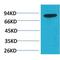 Phosphoinositide-3-Kinase Regulatory Subunit 2 antibody, LS-C387819, Lifespan Biosciences, Western Blot image 