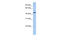 TRNA Methyltransferase 11 Homolog antibody, 26-321, ProSci, Enzyme Linked Immunosorbent Assay image 