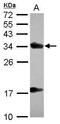 Alpha Tocopherol Transfer Protein antibody, GTX108286, GeneTex, Western Blot image 