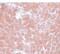 Transmembrane Protein 70 antibody, PA5-20915, Invitrogen Antibodies, Immunohistochemistry paraffin image 