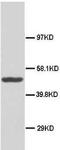 DnaJ Heat Shock Protein Family (Hsp40) Member B1 antibody, LS-C171757, Lifespan Biosciences, Western Blot image 