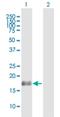 BAALC Binder Of MAP3K1 And KLF4 antibody, H00079870-B01P, Novus Biologicals, Western Blot image 