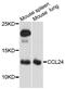 C-C Motif Chemokine Ligand 24 antibody, MBS127635, MyBioSource, Western Blot image 