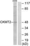 Creatine Kinase, Mitochondrial 2 antibody, TA313626, Origene, Western Blot image 