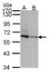 Target Of Myb1 Like 2 Membrane Trafficking Protein antibody, TA308294, Origene, Western Blot image 