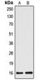 Cytochrome B5 Type A antibody, LS-C352075, Lifespan Biosciences, Western Blot image 