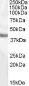 Glutamic-Oxaloacetic Transaminase 1 antibody, EB08132, Everest Biotech, Western Blot image 