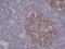Aurora Kinase B antibody, MA5-27890, Invitrogen Antibodies, Immunohistochemistry frozen image 