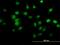 Phosphodiesterase 6D antibody, H00005147-M06, Novus Biologicals, Immunocytochemistry image 