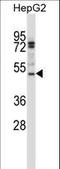 Thyroid Hormone Receptor Interactor 6 antibody, LS-C160218, Lifespan Biosciences, Western Blot image 