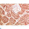 Protein Tyrosine Kinase 2 antibody, LS-C813208, Lifespan Biosciences, Immunohistochemistry paraffin image 
