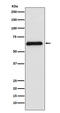 PARP2 antibody, M03270-1, Boster Biological Technology, Western Blot image 