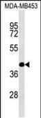 SH2 domain-containing adapter protein F antibody, PA5-48899, Invitrogen Antibodies, Western Blot image 