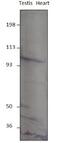 Phosphodiesterase 8B antibody, GTX14621, GeneTex, Western Blot image 