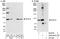 Polycomb protein SUZ12 antibody, A302-407A, Bethyl Labs, Immunoprecipitation image 