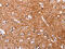 Adipocyte Plasma Membrane Associated Protein antibody, CSB-PA165039, Cusabio, Immunohistochemistry paraffin image 