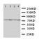 P21 (RAC1) Activated Kinase 6 antibody, orb76242, Biorbyt, Western Blot image 
