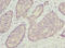 Oligophrenin 1 antibody, LS-C676212, Lifespan Biosciences, Immunohistochemistry paraffin image 