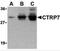 C1q And TNF Related 7 antibody, 3673, ProSci, Western Blot image 