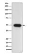 TGF beta antibody, M00019-4, Boster Biological Technology, Western Blot image 