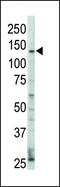 HER4 antibody, 63-072, ProSci, Western Blot image 