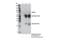 Nuclear Receptor Coactivator 4 antibody, 66849S, Cell Signaling Technology, Immunoprecipitation image 