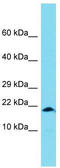 G antigen family D member 2 antibody, TA335920, Origene, Western Blot image 
