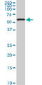 Histone Deacetylase 1 antibody, LS-B6094, Lifespan Biosciences, Western Blot image 