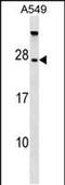 TBC1 Domain Family Member 28 antibody, PA5-48773, Invitrogen Antibodies, Western Blot image 