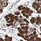 TPD52 Like 1 antibody, NBP1-84313, Novus Biologicals, Immunohistochemistry paraffin image 