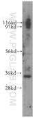 General transcription factor IIE subunit 2 antibody, 11596-1-AP, Proteintech Group, Western Blot image 