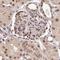 General Transcription Factor IIIC Subunit 6 antibody, HPA056179, Atlas Antibodies, Immunohistochemistry paraffin image 