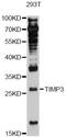 TIMP Metallopeptidase Inhibitor 3 antibody, LS-C747218, Lifespan Biosciences, Western Blot image 