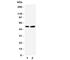 Selenium Binding Protein 1 antibody, R31340, NSJ Bioreagents, Western Blot image 