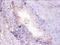 Proteasome Subunit Alpha 7 antibody, CSB-PA01335A0Rb, Cusabio, Immunohistochemistry paraffin image 