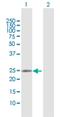 RAB37, Member RAS Oncogene Family antibody, H00326624-D01P, Novus Biologicals, Western Blot image 