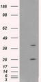 Glutamate-Ammonia Ligase antibody, CF500700, Origene, Western Blot image 