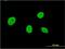 Nucleolar Protein 4 antibody, MA5-24429, Invitrogen Antibodies, Immunofluorescence image 