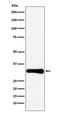 BCL10 Immune Signaling Adaptor antibody, M01616-4, Boster Biological Technology, Western Blot image 
