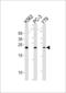 Glutathione S-transferase P 1 antibody, LS-C166714, Lifespan Biosciences, Western Blot image 