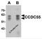 Nuclear Speckle Splicing Regulatory Protein 1 antibody, 6519, ProSci, Western Blot image 