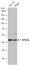 Protein Phosphatase, Mg2+/Mn2+ Dependent 1A antibody, NBP1-32751, Novus Biologicals, Western Blot image 