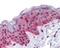 Polo Like Kinase 1 antibody, PA5-28023, Invitrogen Antibodies, Immunohistochemistry paraffin image 