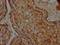 TNF Receptor Superfamily Member 12A antibody, CSB-RA441307A0HU, Cusabio, Immunohistochemistry frozen image 