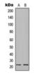 Ig lambda-1 chain C regions antibody, orb393079, Biorbyt, Western Blot image 