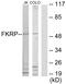 Fukutin Related Protein antibody, GTX87580, GeneTex, Western Blot image 